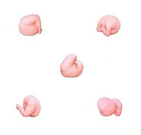n1l